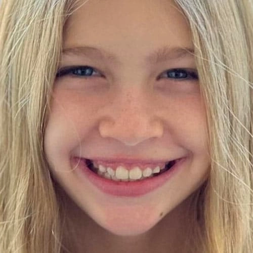 Photo-social-proof-little-blonde-girl-smile-after-Invisalign-treatment