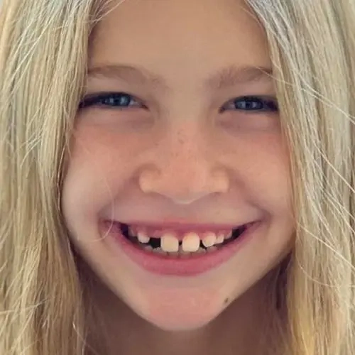 Photo-social-proof-little-blonde-girl-smile-before-Invisalign-treatment