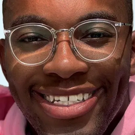 Photo-social-proof-man-with-glasses-smile-before-Invisalign-treatment