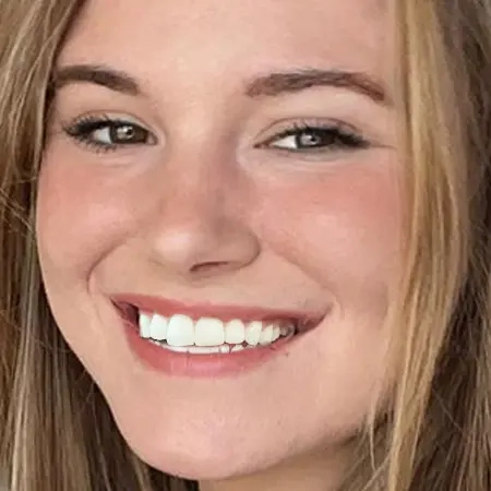 Photo-social-proof-teen-girl-smile-before-Invisalign-treatmentwebp