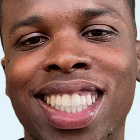 Photo-social-proof-young-man-smile-after-Invisalign-treatment