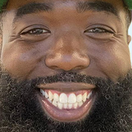 ugc-slider-after-man-with-beard-smile-after-Invisalign-treatment